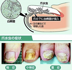 爪水虫